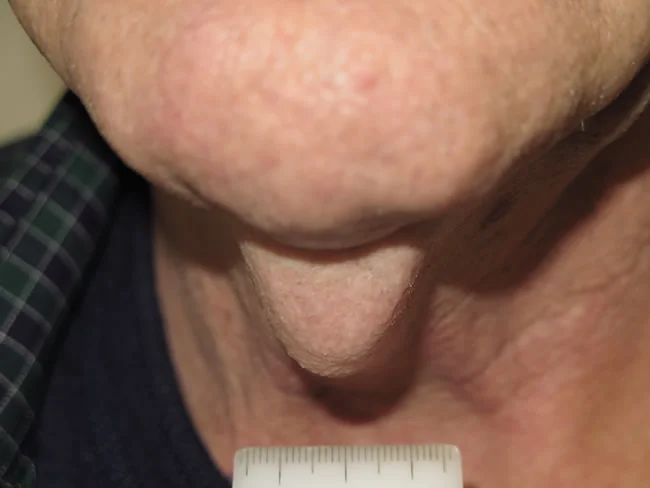 neck image
