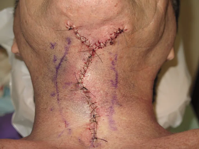 neck image