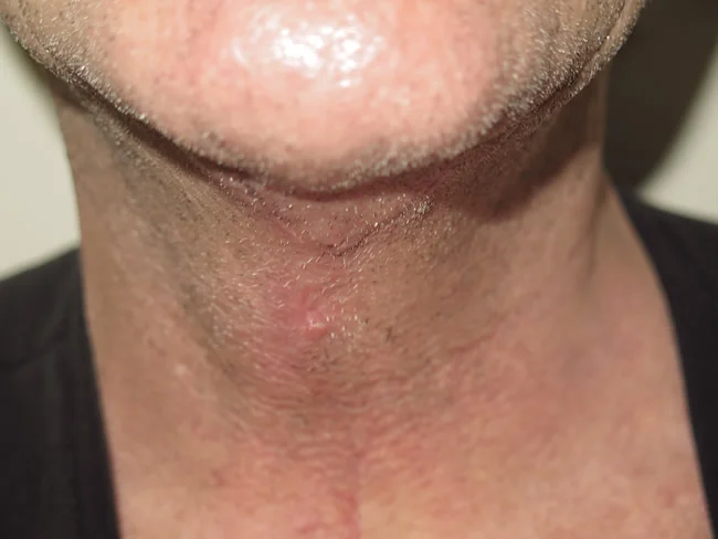 neck image