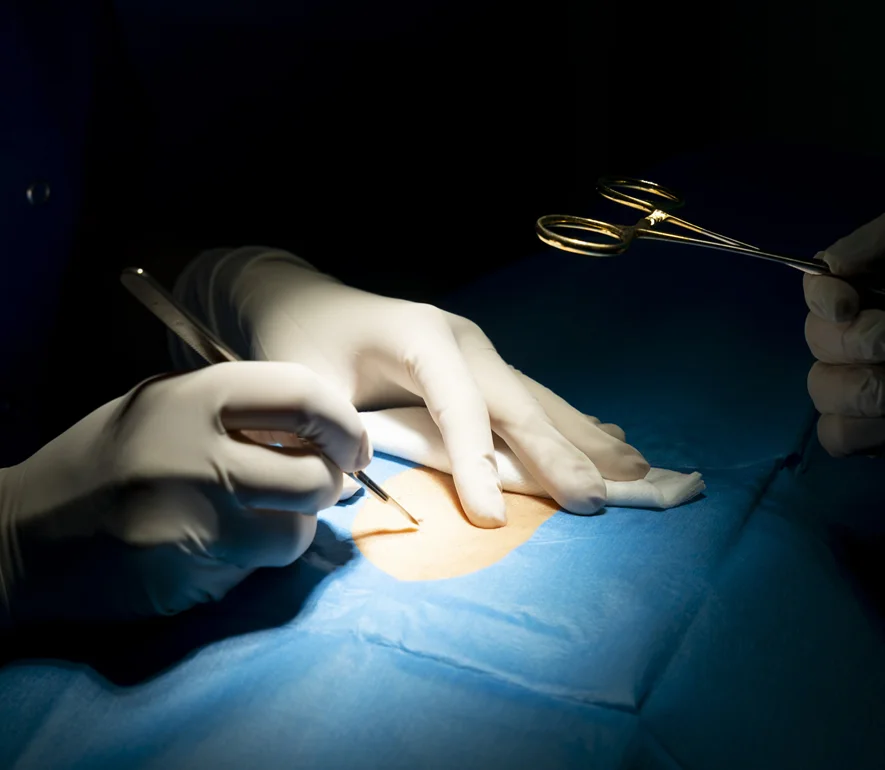 surgical dermatology aesthetic services image