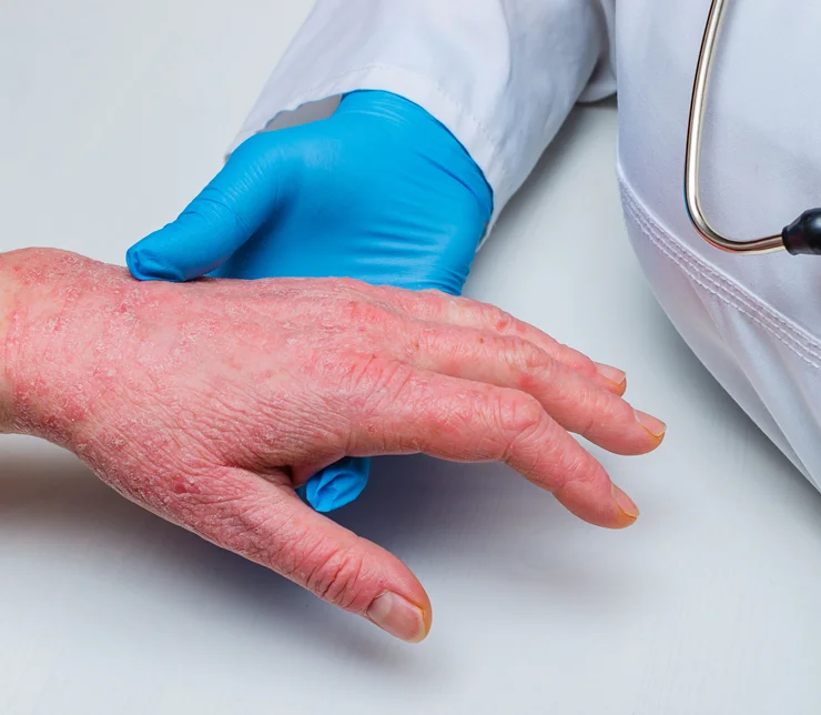 medical dermatology image
