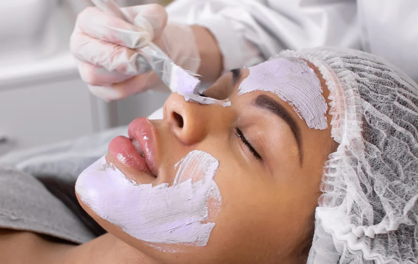 Chemical Peel image