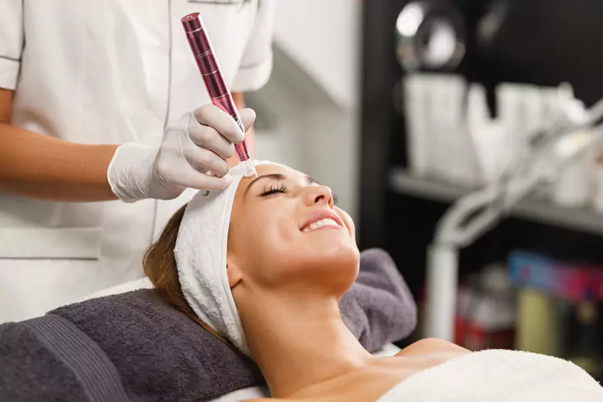 Microneedling image