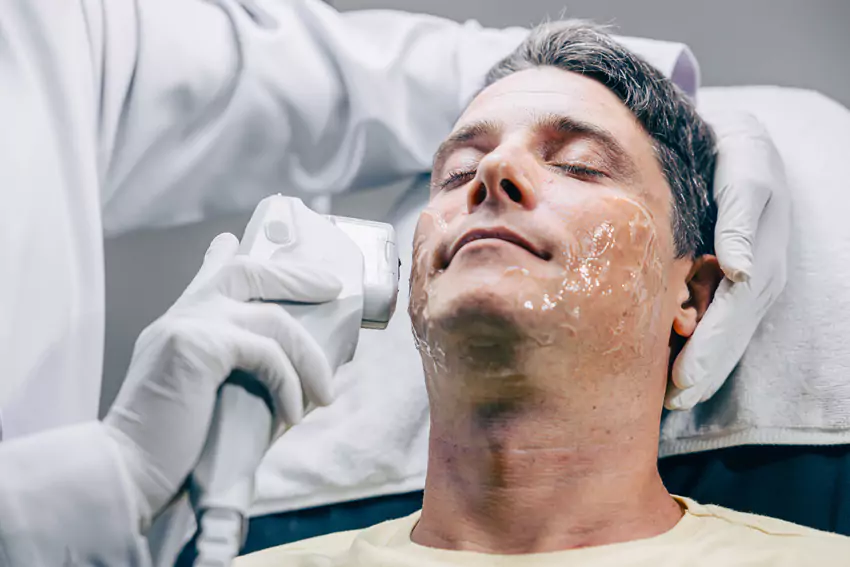 Broad Band Light (BBL) Laser Treatment image